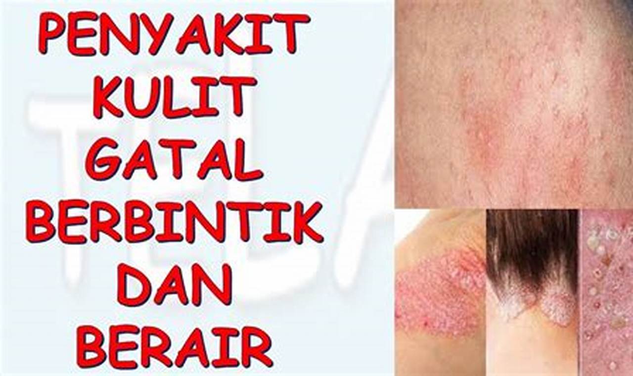 Cara Mengatasi Gatal Gatal Pada Kulit